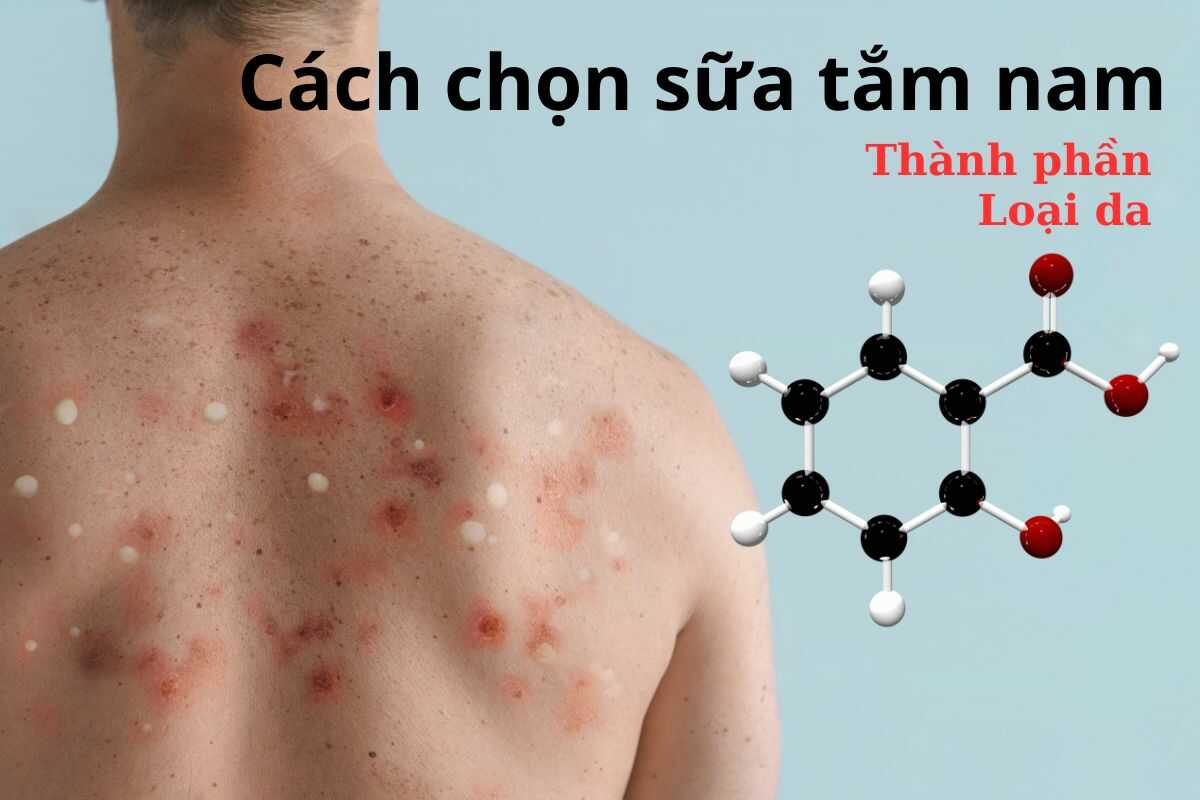 Cách chọn sữa tắm trị mụn lưng cho nam an toàn và hiệu quả