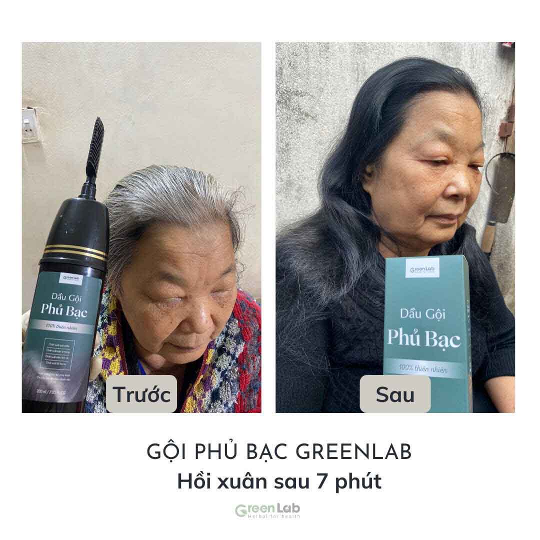 Ảnh sản phẩm